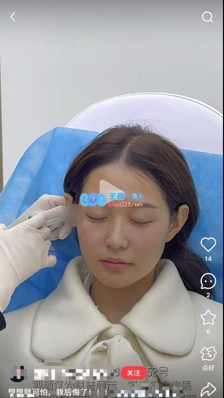 豆瓣网友揭Meiko女友内幕：出售假货且整容变精灵耳却不愿坦承