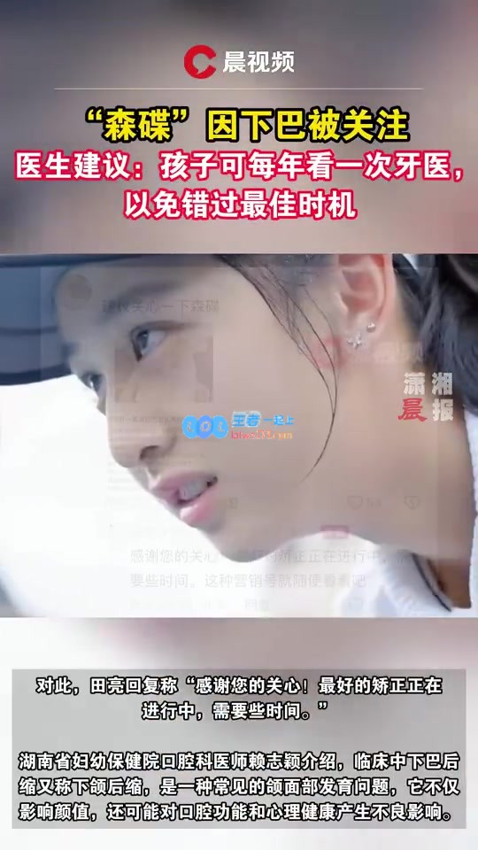 演员田亮女儿下巴后缩引发热议医生称这一现象将对颜值产生影响