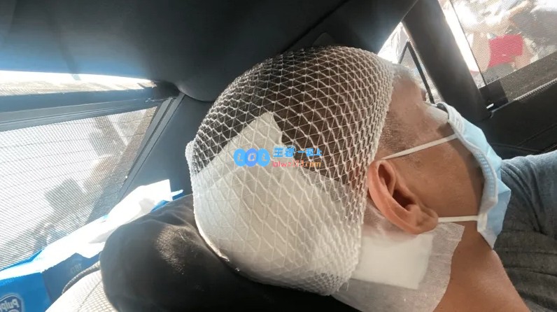 惊悚开瓢事件??LCP赛区宣传片全程搞笑GAMP老板竟被真酒瓶送入医院